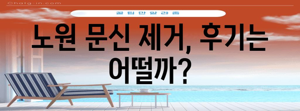 노원 문신 제거후기 | 비용과 주의사항